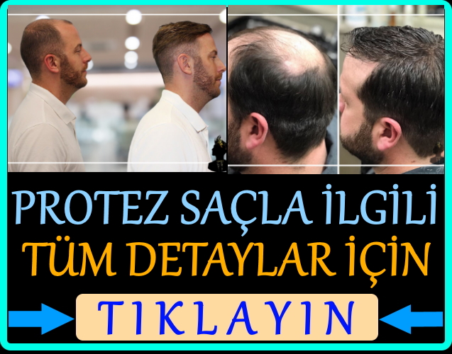 Tap Hair Türkiye Akademik Protez Saç Bakım Ürünleri
