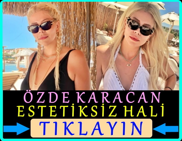 özde karacan estetiksiz hali fotoğrafları