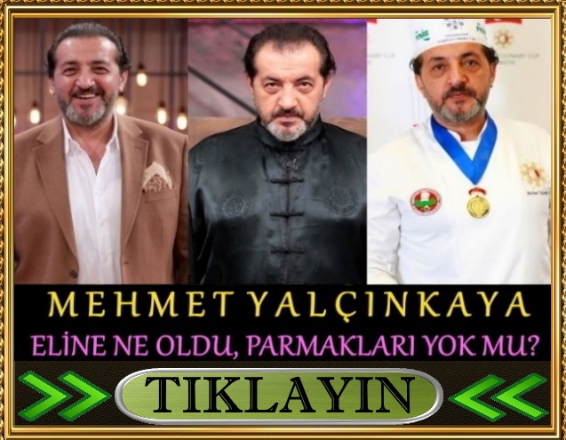 mehmet yalçınkaya şef eli ne oldu parmakları yok mu