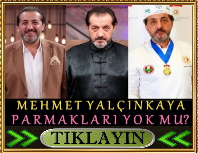 masterchef mehmet yalçınkaya sol el parmağına ne oldu