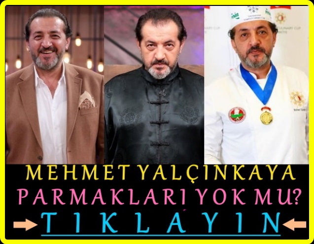 masterchef mehmet yalçınkaya sol eli ne oldu