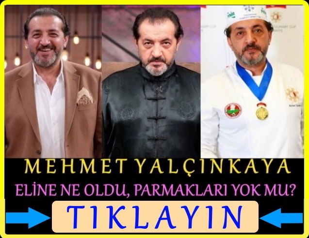 mehmet yalçınkaya eli ne oldu, parmakları yok mu