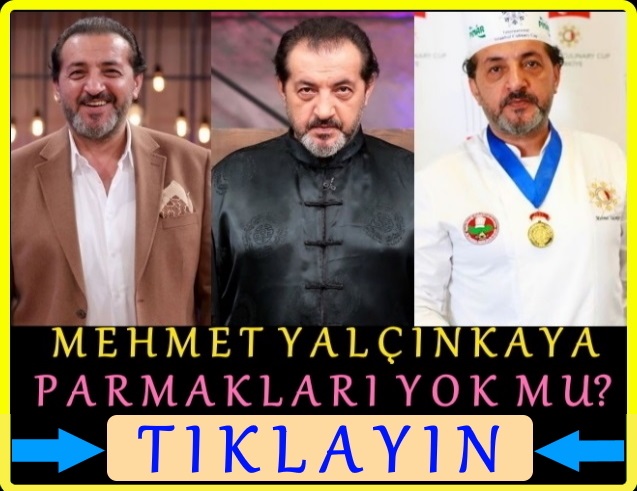 masterchef mehmet yalçınkaya şef parmakları yok mu