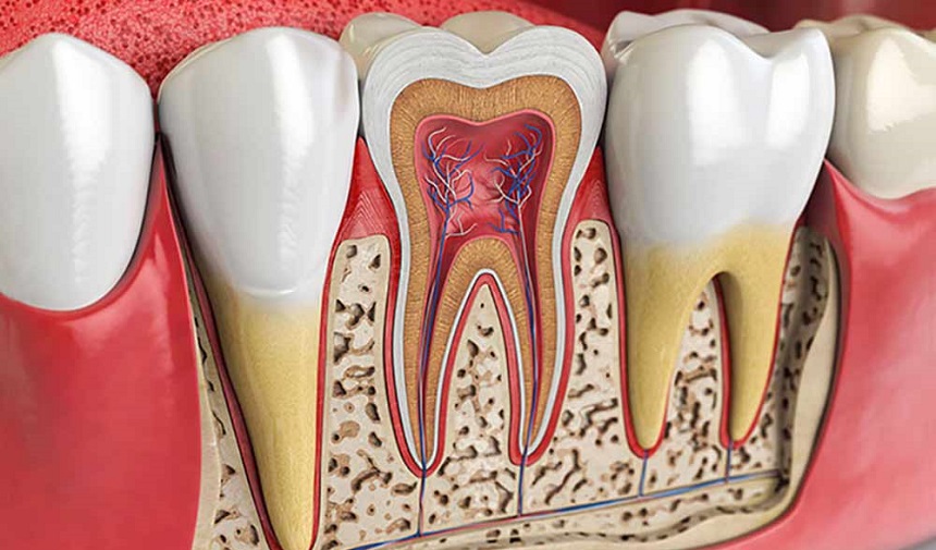 Kanal Tedavisi Nasıl Yapılır