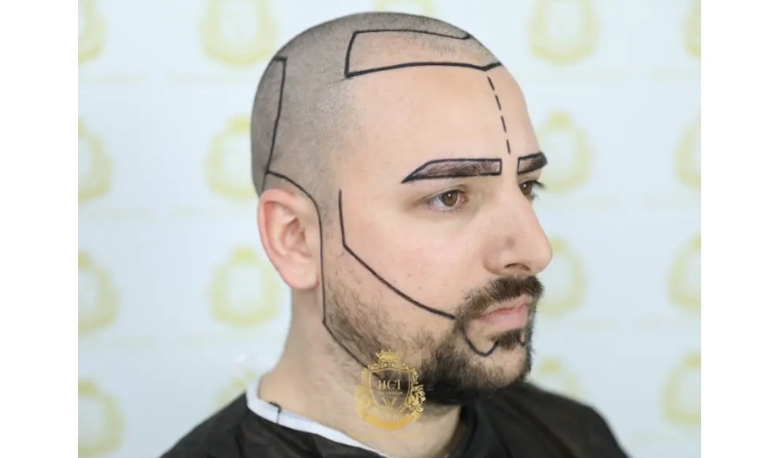 Kaş Ekimi Fiyatları