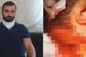 Torbalı, İzmir Büyükşehir Belediyesi, ESHOT, Torbalı Belediyesi