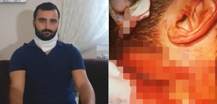 Torbalı, İzmir Büyükşehir Belediyesi, ESHOT, Torbalı Belediyesi