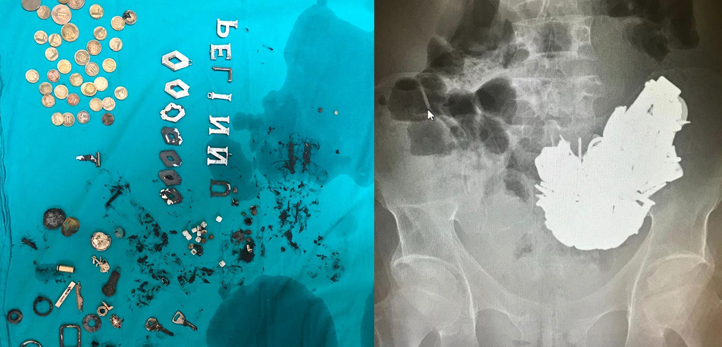 Torbalı, Torbalı elektrik kesintisi, izmir elektrik kesintisi