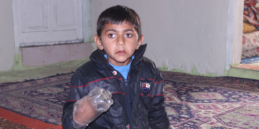 Ellerini ısıran 7 yaşındaki Yusuf Maden'in dramı yürekleri dağlıyor