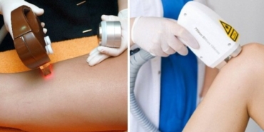 izmir gaziemir acısız lazer epilasyon ile tanışın!