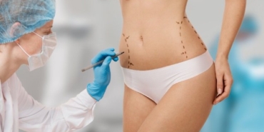 Liposuction Estetik Yöntemleri Nelerdir? – Dr. Ekrem Keskin