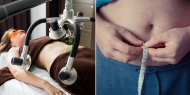 Liposuction Yöntemleri Nelerdir?