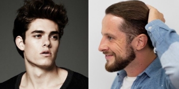 Protez saç nasıl yapılır?