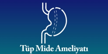 Kilo vermenin etkili yolu tüp mide ameliyatı