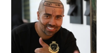 Adım Adım Kaş Ekimi ve Merak Edilenler