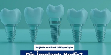 Sağlıklı ve Güzel Gülüşler İçin: Diş İmplantı Nedir?