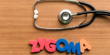 Zygoma İmplantı ile İlgili Bilinmesi Gereken 6 Husus