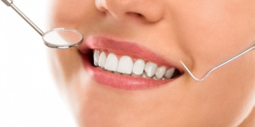 Emax Kaplama: Diş Estetiğinde Devrim Yaratın