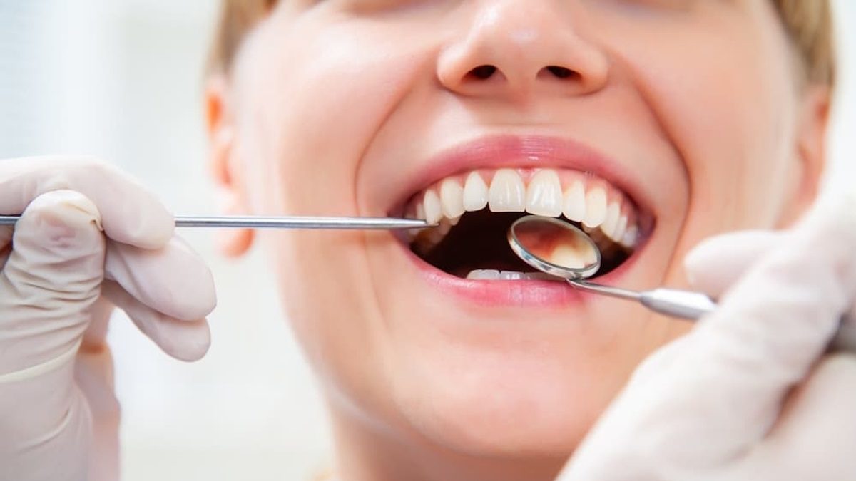 Dent Leon’da Ortodonti Tedavisi ile Mükemmel Gülüşe Kavuşun.