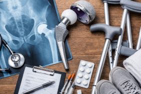 Kalça Protezi Ameliyatı, Fiyatları ve Sonrası İyileşme Süreci