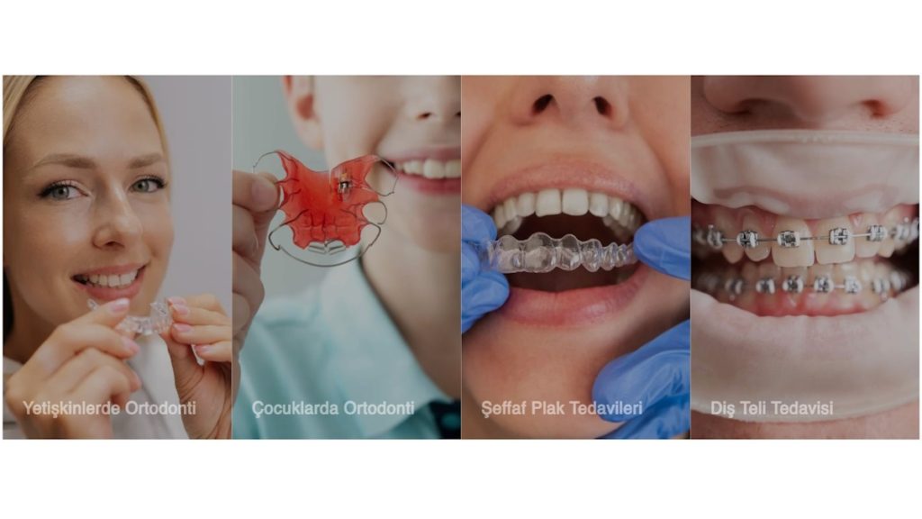 İzmir Ortodonti Kliniği, Sağlıklı ve Estetik Gülüş İçin Modern Ortodonti Tedavileri
