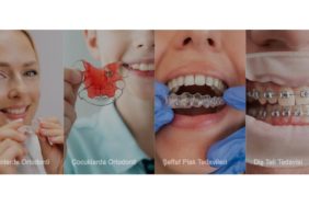 İzmir Ortodonti Kliniği, Sağlıklı ve Estetik Gülüş İçin Modern Ortodonti Tedavileri