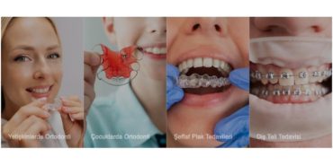 İzmir Ortodonti Kliniği, Sağlıklı ve Estetik Gülüş İçin Modern Ortodonti Tedavileri