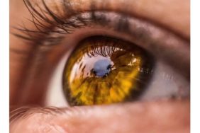 Laser Depigmentation ile Göz Rengi Değiştirme Süreci