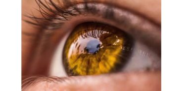 Laser Depigmentation ile Göz Rengi Değiştirme Süreci