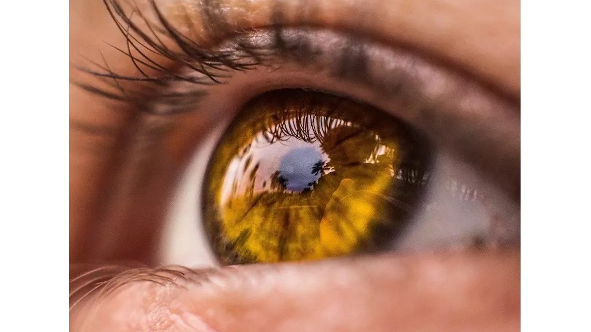 Laser Depigmentation ile Göz Rengi Değiştirme Süreci