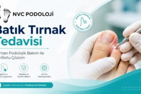 İzmir’de Batık Tırnak Sorununa Konforlu Çözüm: NVC Podoloji Alsancak’ta Hizmet Veriyor